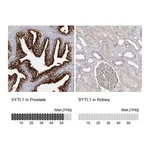 Atlas Antibodies Anti-SYTL1 Antibody