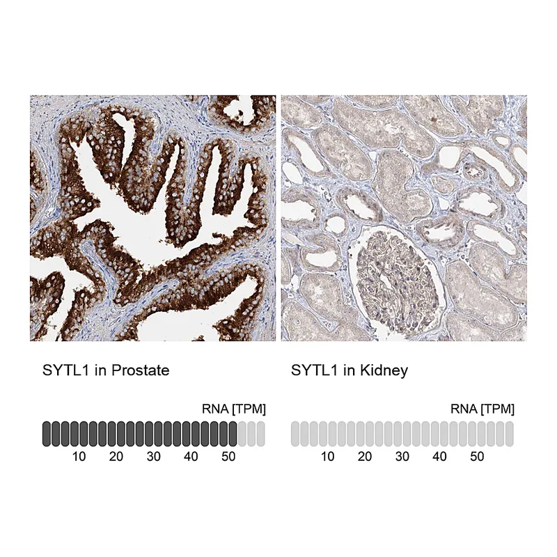 Atlas Antibodies Anti-SYTL1 Antibody