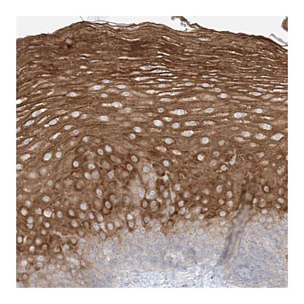 Atlas Antibodies Anti-SYTL3 Antibody