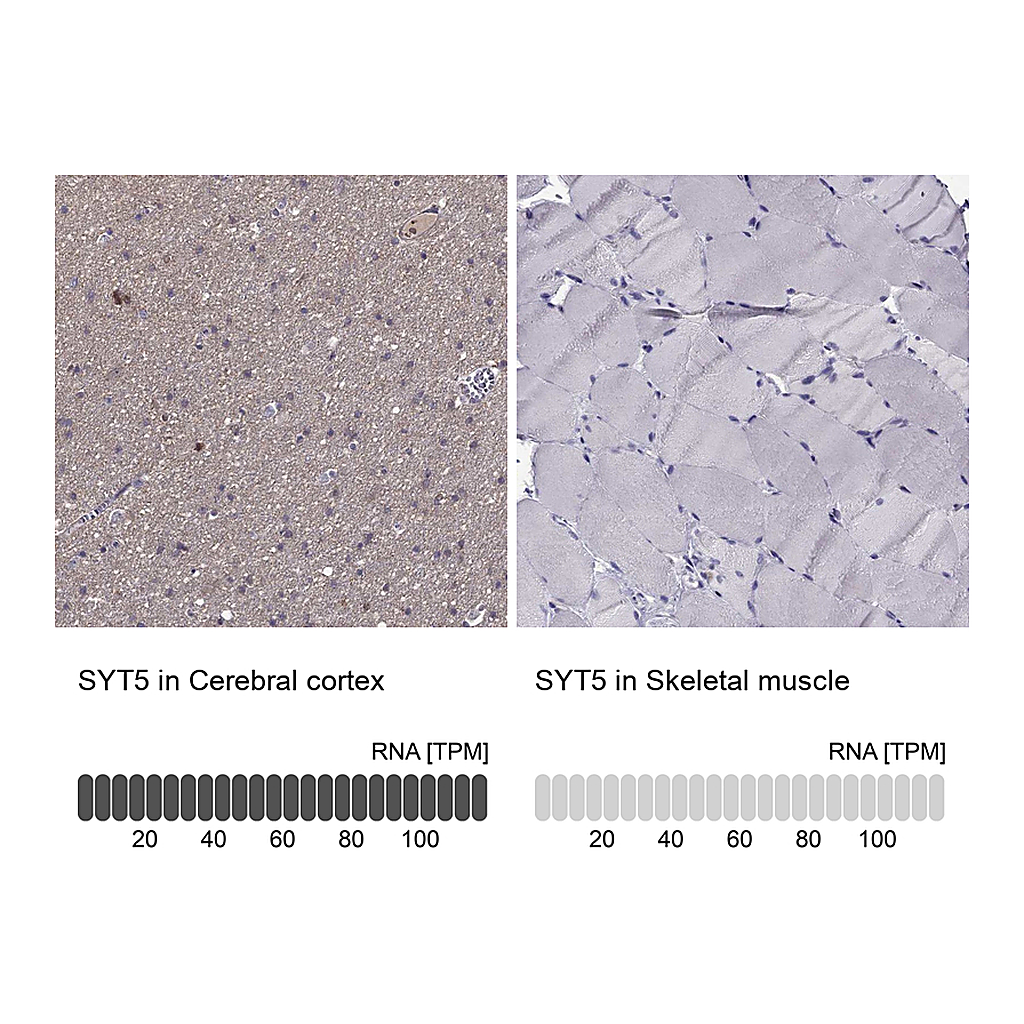 Atlas Antibodies Anti-SYT5 Antibody