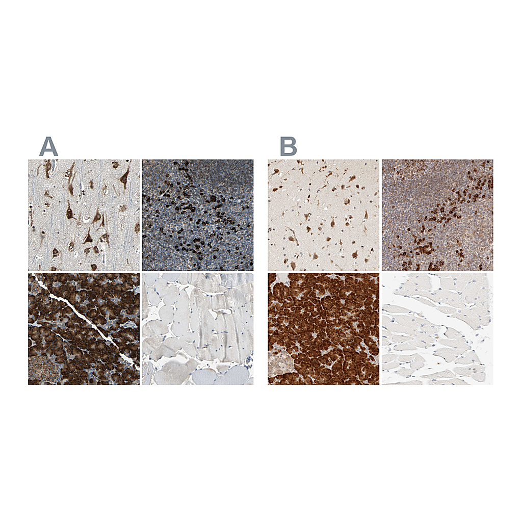 Atlas Antibodies Anti-SYVN1 Antibody
