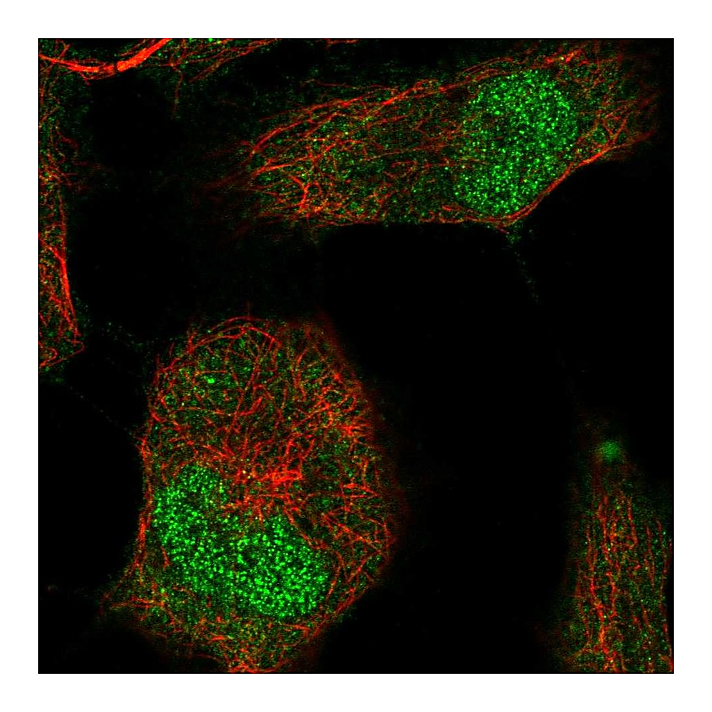 Atlas Antibodies Anti-T Antibody