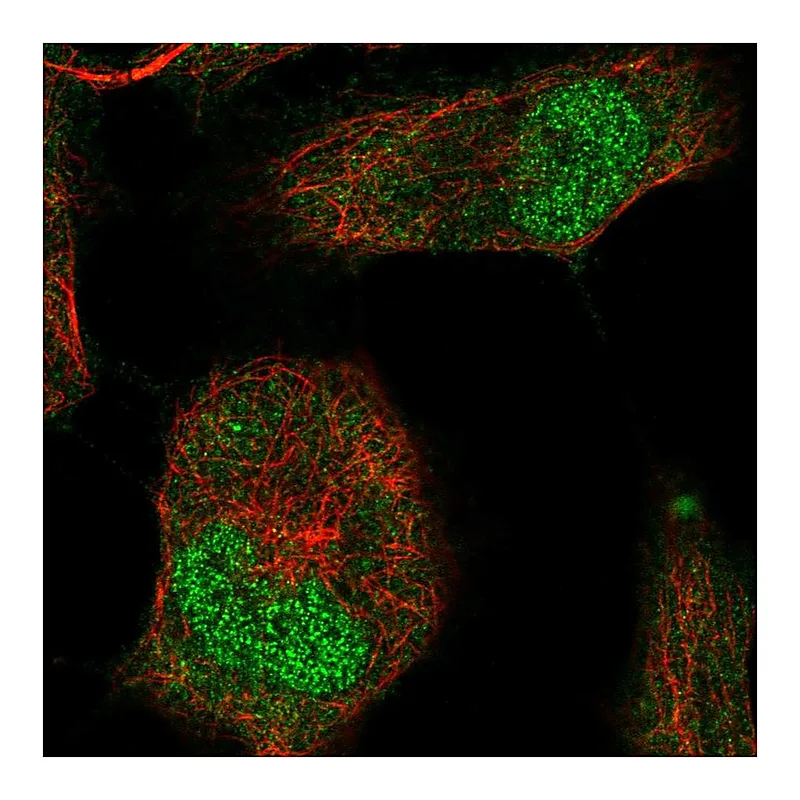 Atlas Antibodies Anti-T Antibody