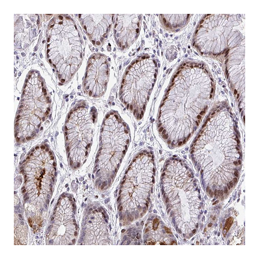 Atlas Antibodies Anti-TAB1 Antibody