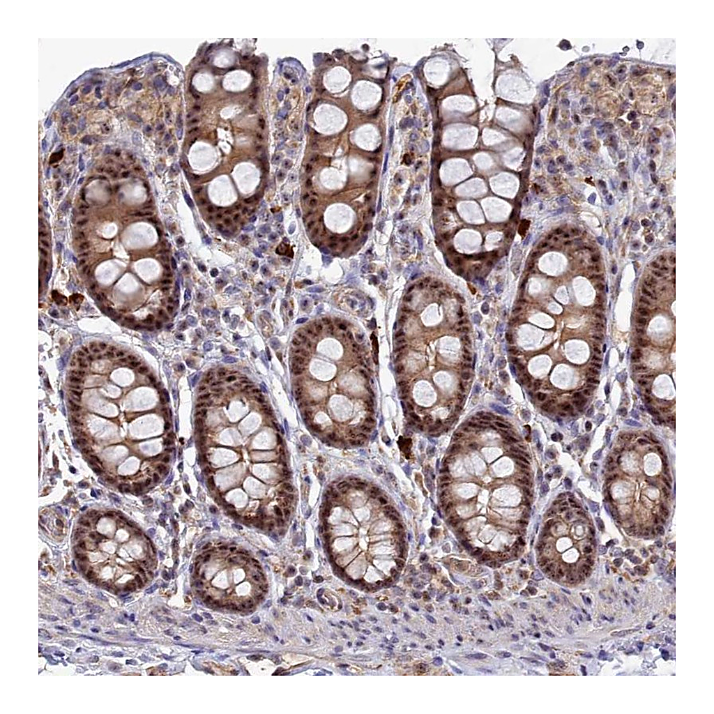Atlas Antibodies Anti-TAB1 Antibody
