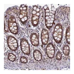 Atlas Antibodies Anti-TAB1 Antibody