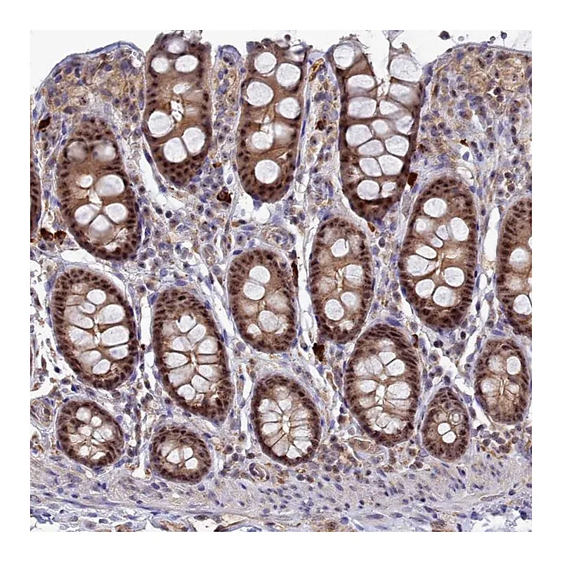 Atlas Antibodies Anti-TAB1 Antibody