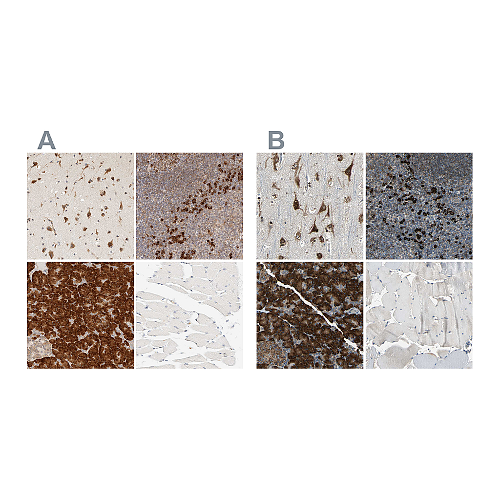 Atlas Antibodies Anti-SYVN1 Antibody