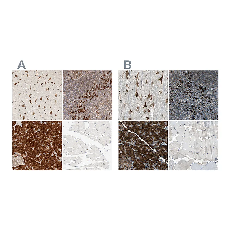 Atlas Antibodies Anti-SYVN1 Antibody