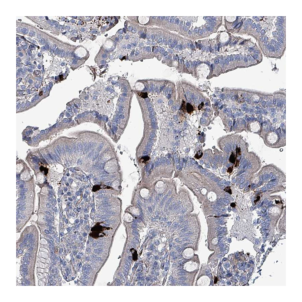 Atlas Antibodies Anti-TAAR5 Antibody