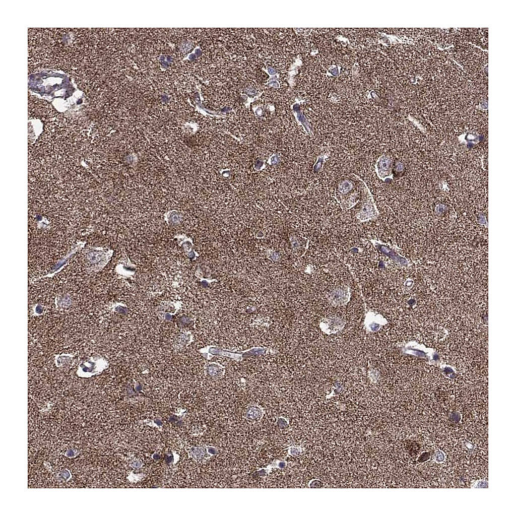 Atlas Antibodies Anti-TAB2 Antibody