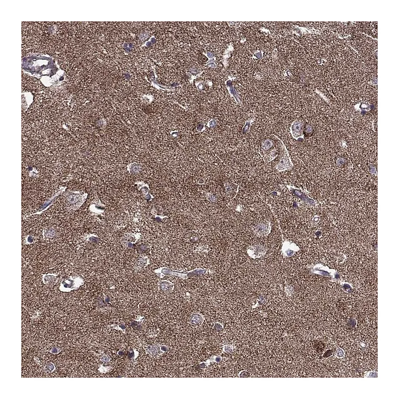Atlas Antibodies Anti-TAB2 Antibody