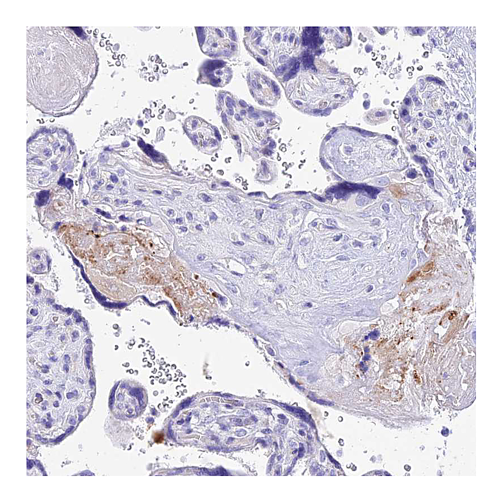 Atlas Antibodies Anti-TAC3 Antibody