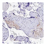 Atlas Antibodies Anti-TAC3 Antibody