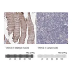 Atlas Antibodies Anti-TACC2 Antibody