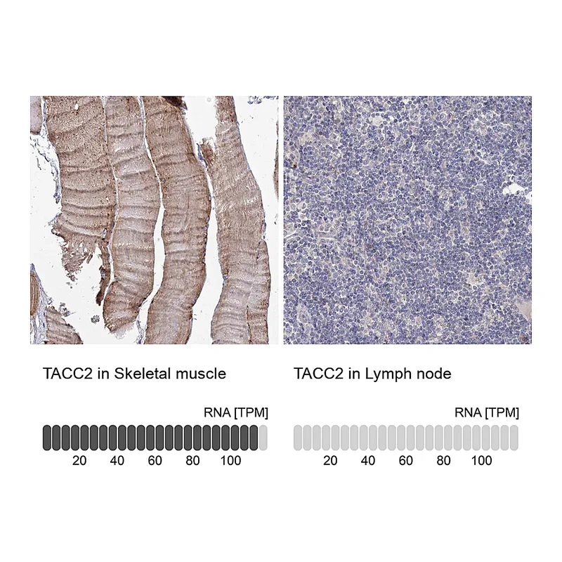 Atlas Antibodies Anti-TACC2 Antibody