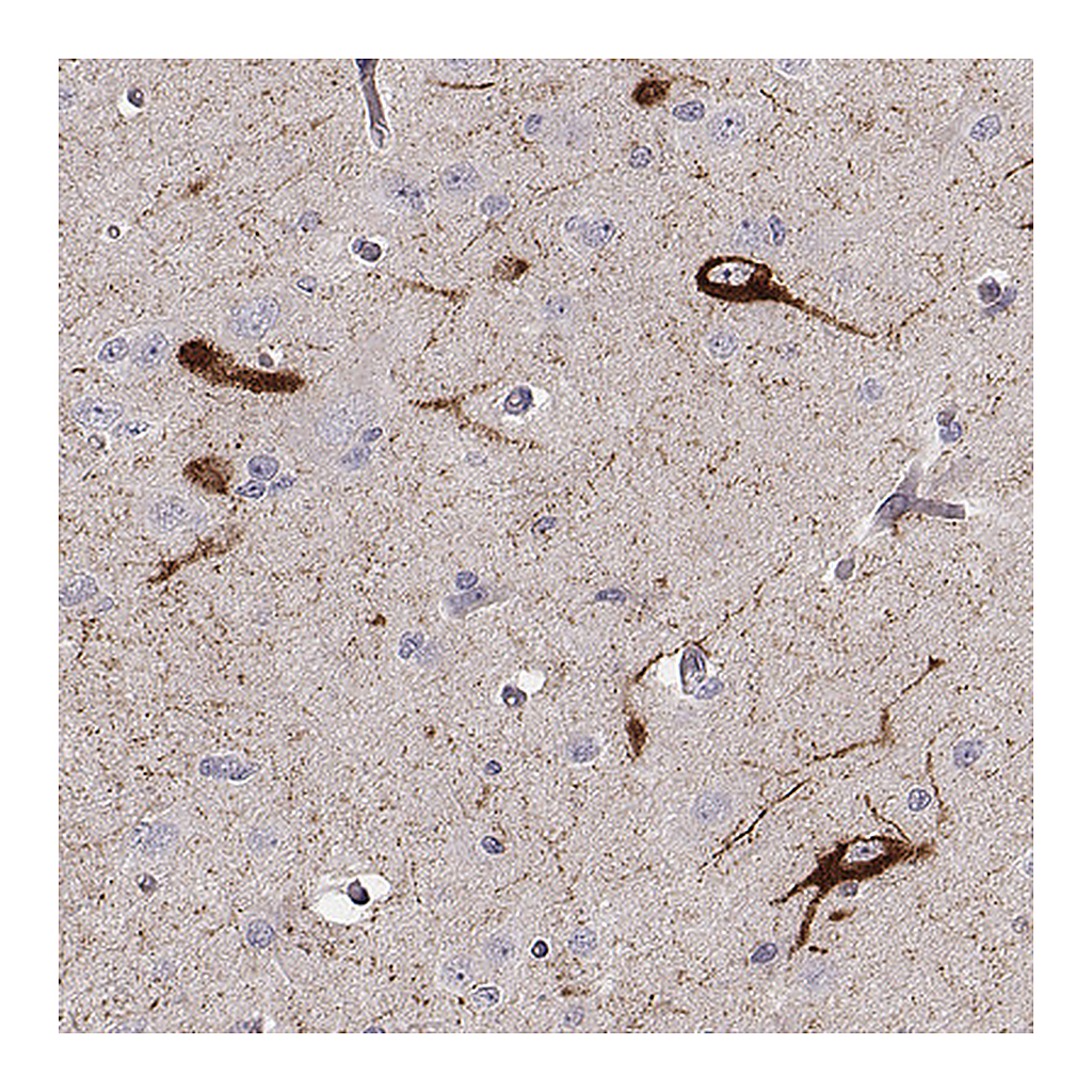 Atlas Antibodies Anti-TAC1 Antibody