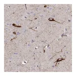 Atlas Antibodies Anti-TAC1 Antibody