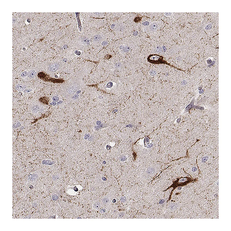 Atlas Antibodies Anti-TAC1 Antibody