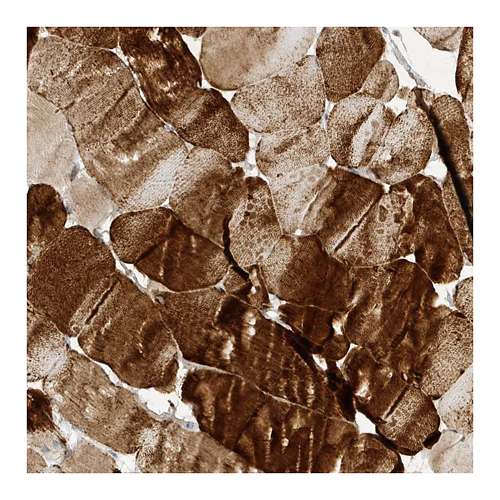 Atlas Antibodies Anti-TAB3 Antibody