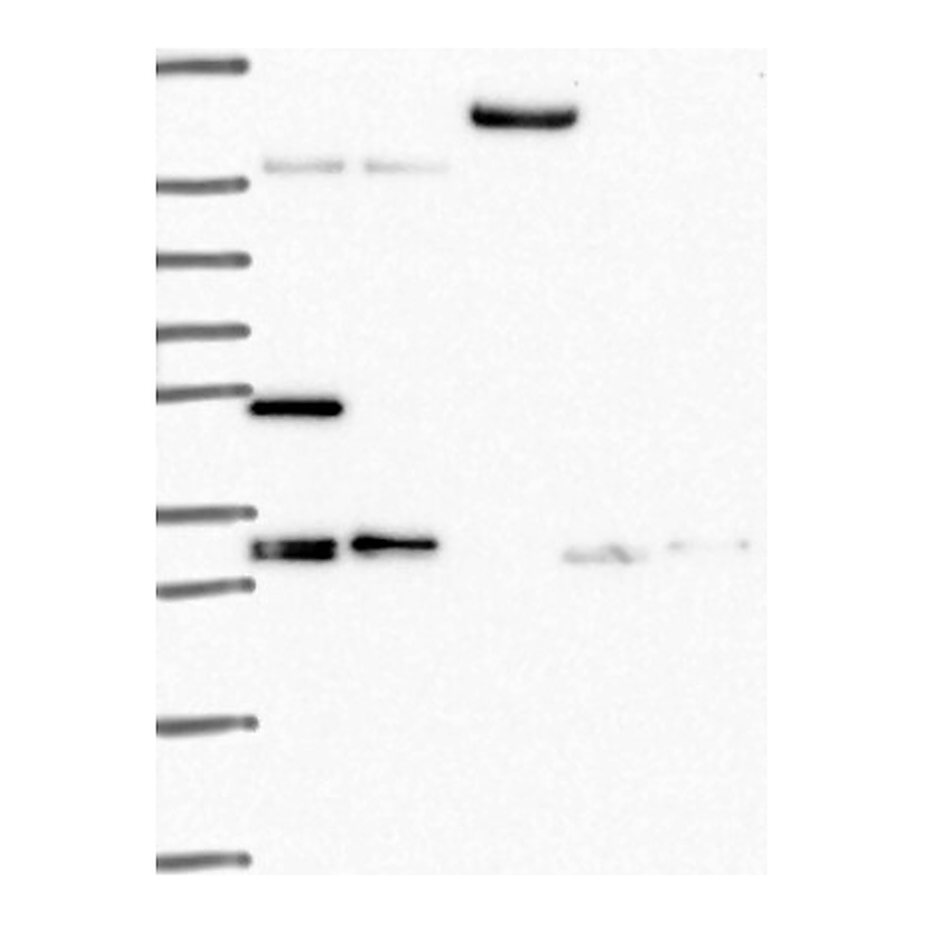 Atlas Antibodies Anti-TACC1 Antibody