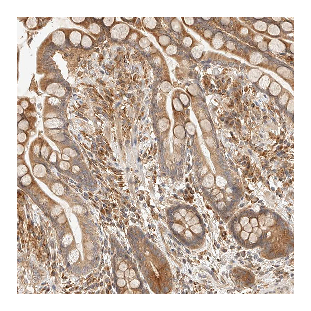 Atlas Antibodies Anti-TACC1 Antibody