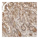 Atlas Antibodies Anti-TACC1 Antibody