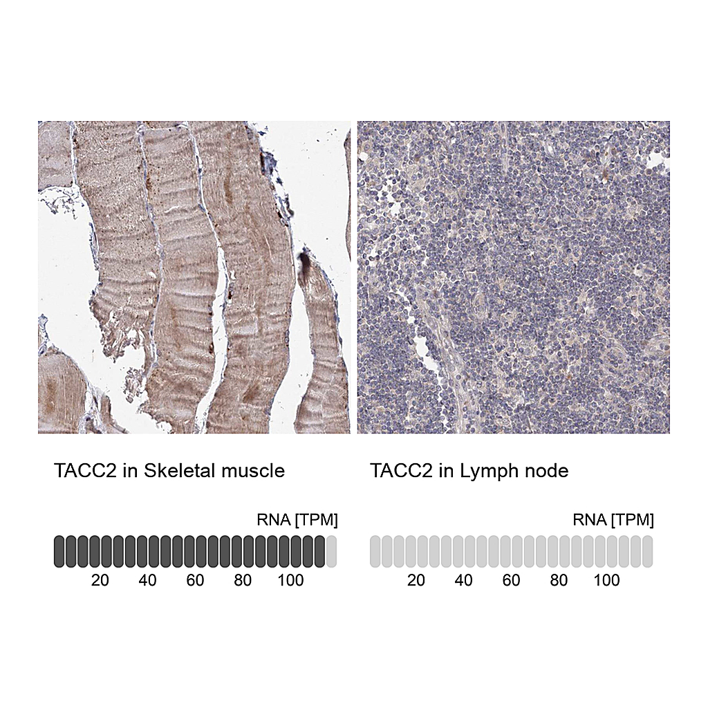 Atlas Antibodies Anti-TACC2 Antibody