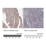 Atlas Antibodies Anti-TACC2 Antibody