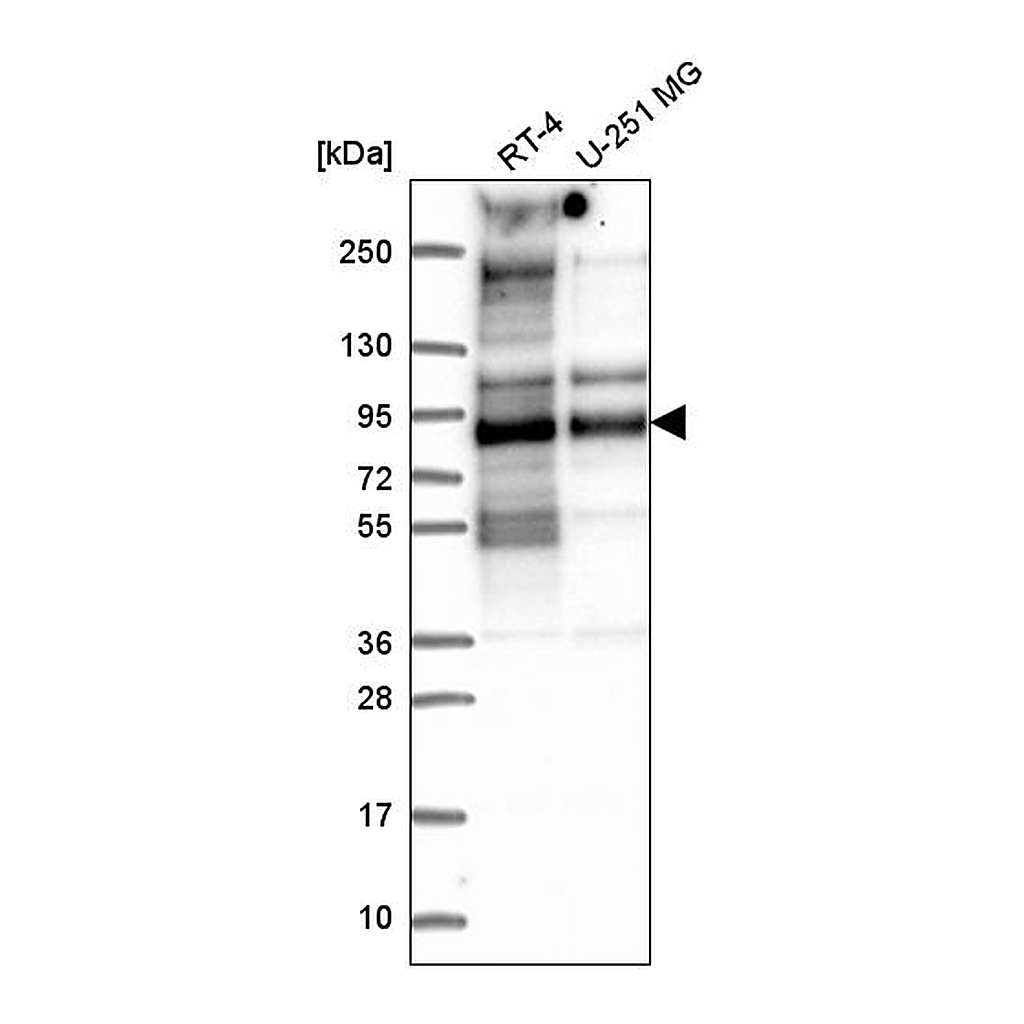 Atlas Antibodies Anti-TACC2 Antibody