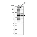 Atlas Antibodies Anti-TACC2 Antibody
