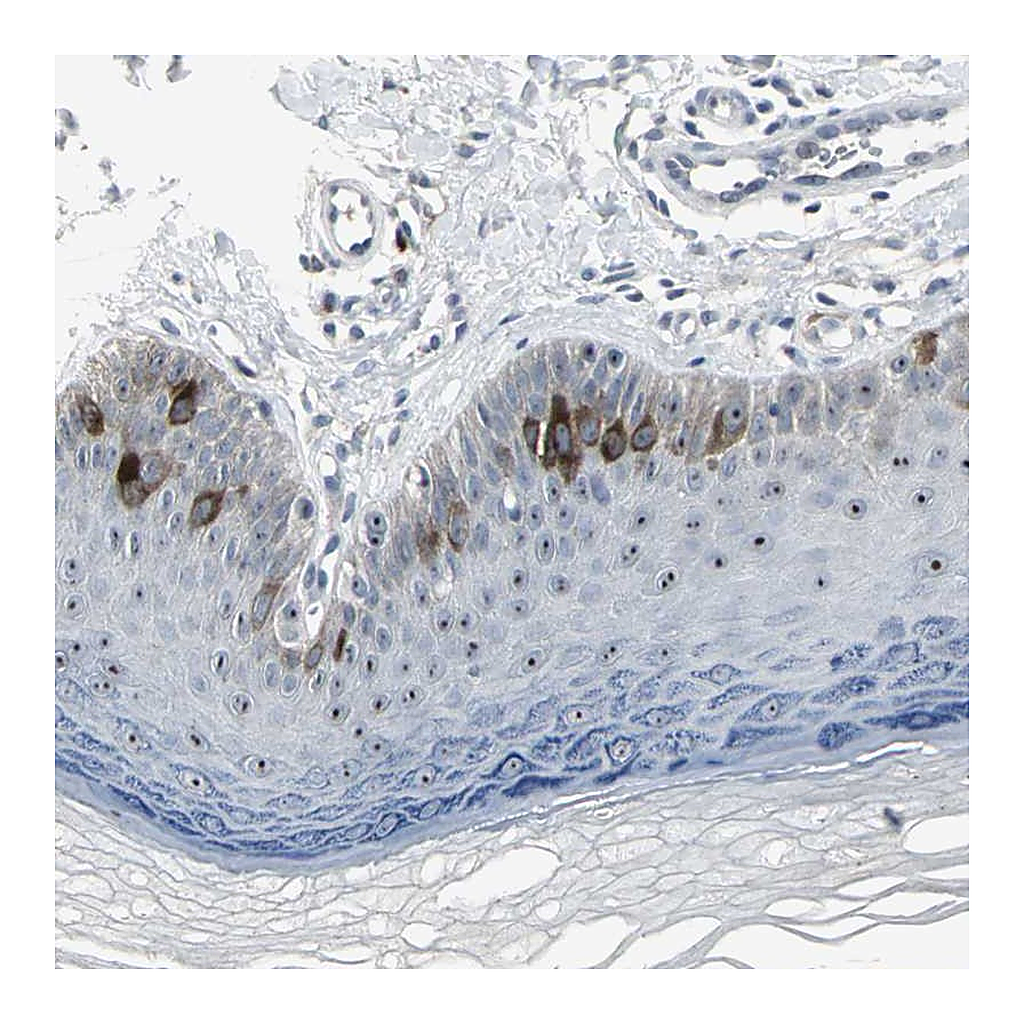 Atlas Antibodies Anti-TACC3 Antibody