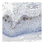 Atlas Antibodies Anti-TACC3 Antibody