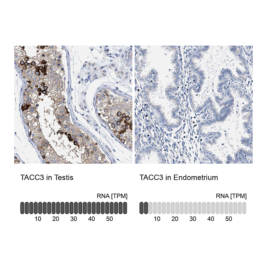 Atlas Antibodies Anti-TACC3 Antibody
