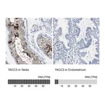 Atlas Antibodies Anti-TACC3 Antibody