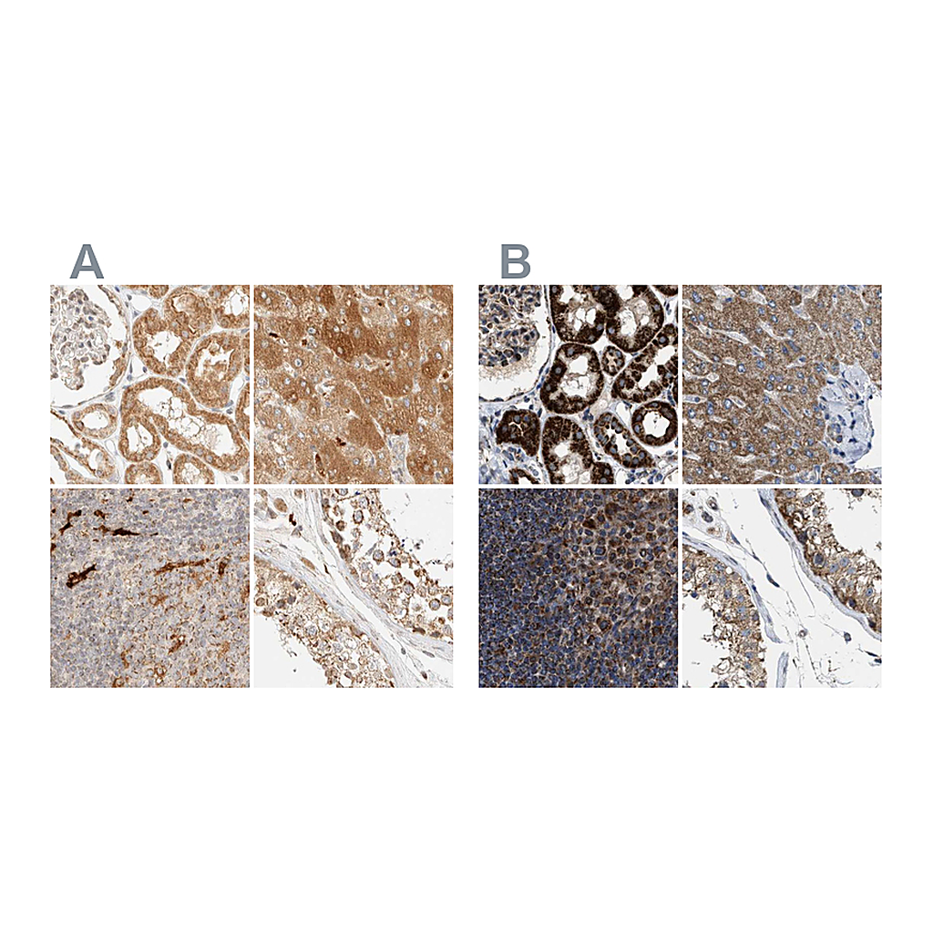 Atlas Antibodies Anti-TACO1 Antibody