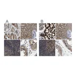 Atlas Antibodies Anti-TACO1 Antibody