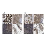 Atlas Antibodies Anti-TACO1 Antibody