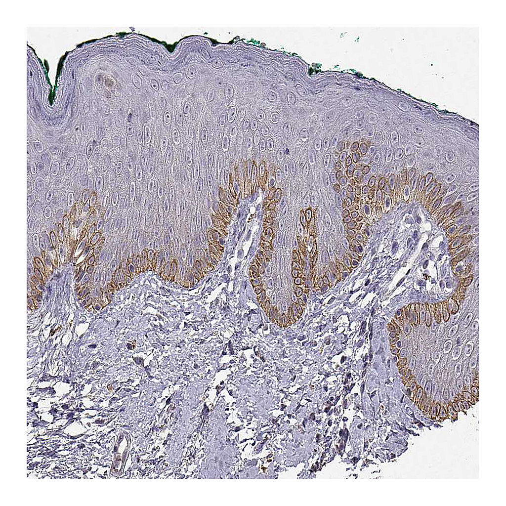 Atlas Antibodies Anti-TACR1 Antibody