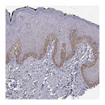 Atlas Antibodies Anti-TACR1 Antibody