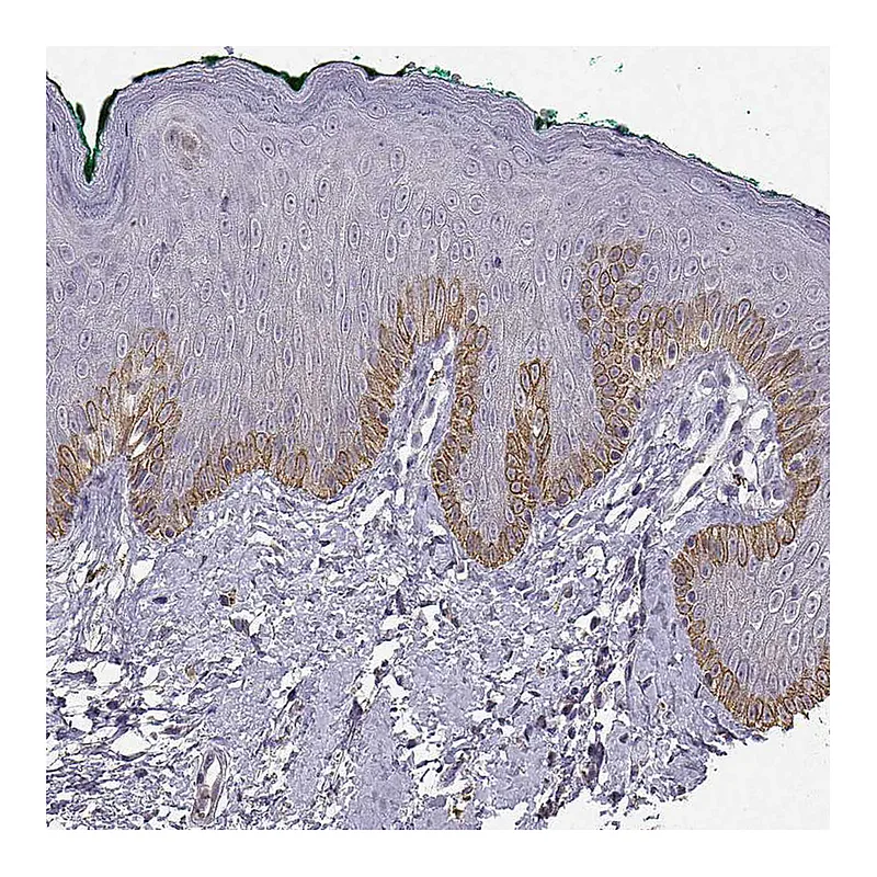 Atlas Antibodies Anti-TACR1 Antibody