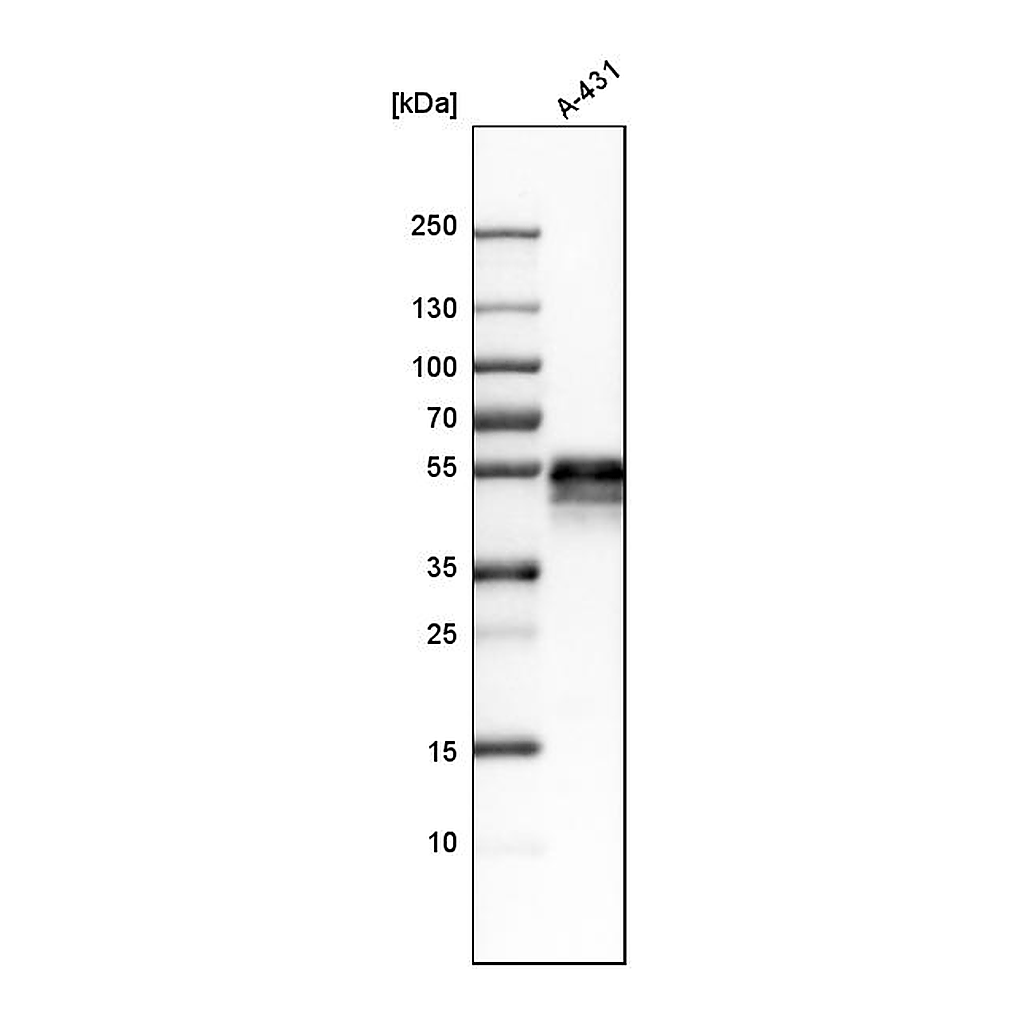 Atlas Antibodies Anti-TACSTD2 Antibody