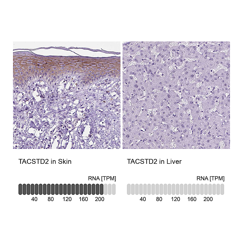 Atlas Antibodies Anti-TACSTD2 Antibody