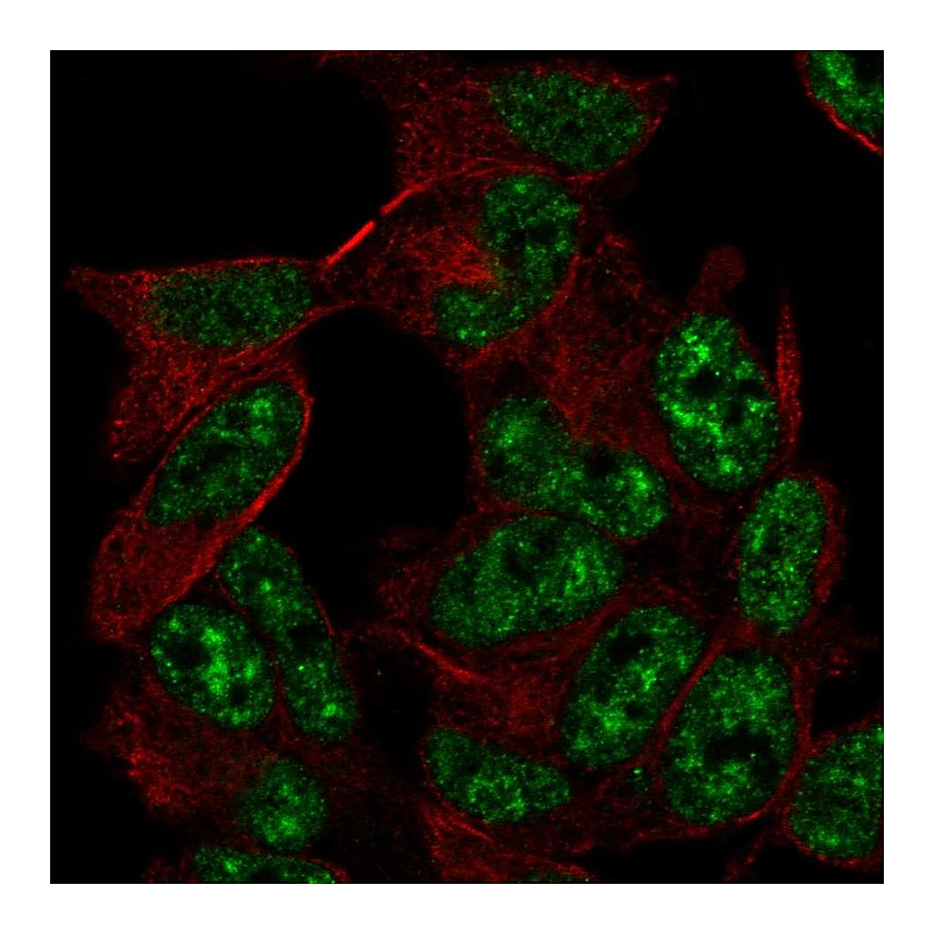 Atlas Antibodies Anti-TADA2A Antibody