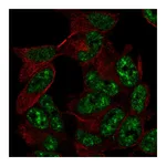 Atlas Antibodies Anti-TADA2A Antibody