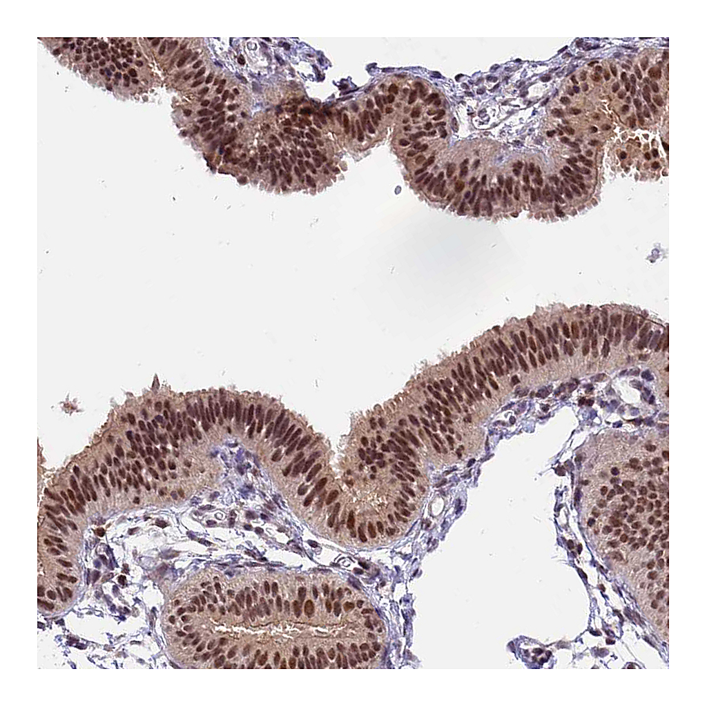 Atlas Antibodies Anti-TADA3 Antibody