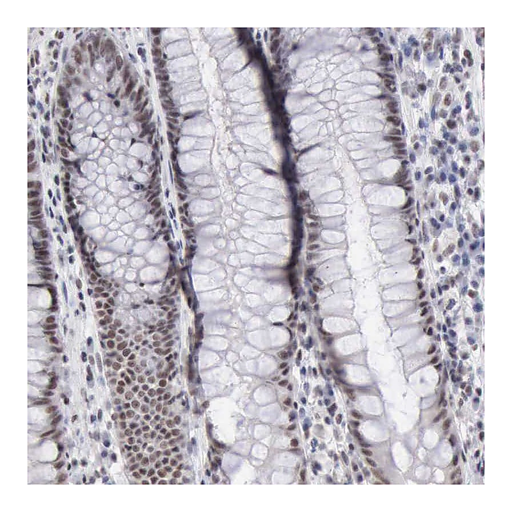 Atlas Antibodies Anti-TAF1 Antibody