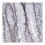 Atlas Antibodies Anti-TAF1 Antibody