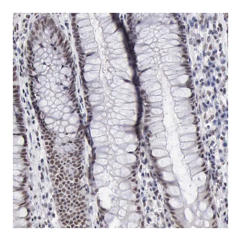 Atlas Antibodies Anti-TAF1 Antibody