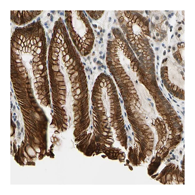 Atlas Antibodies Anti-TAF12 Antibody